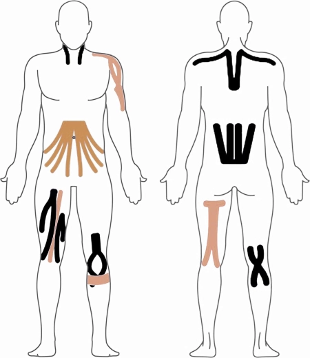 Καθολική εφαρμογή σε όλο το σώμα